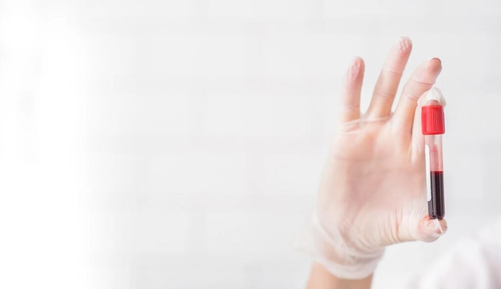 Blood tests that predict Alzheimer’s 10 years early – are we ready for the future?