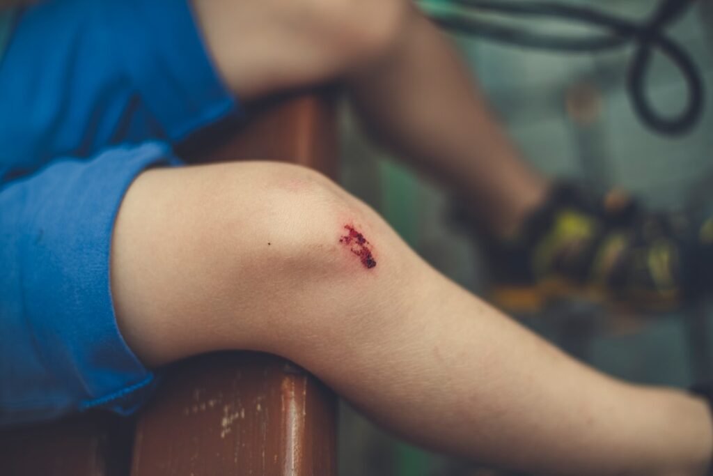 discover effective strategies and tips for optimal wound recovery to promote faster healing and reduce scarring.